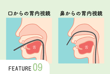 鼻からも口も全て経鼻用の細径スコープを使用します