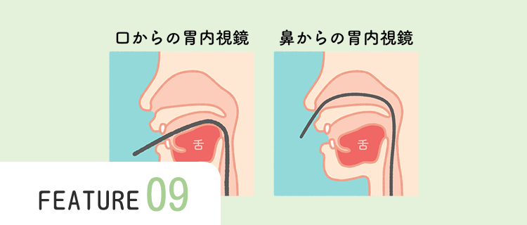 鼻からも口も全て経鼻用の細径スコープを使用します