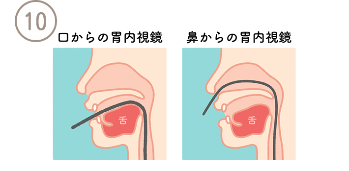 鼻からも口も全て経鼻用の細径スコープを使用します