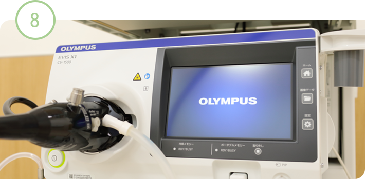 最新の内視鏡システム「EVIS X1」導入