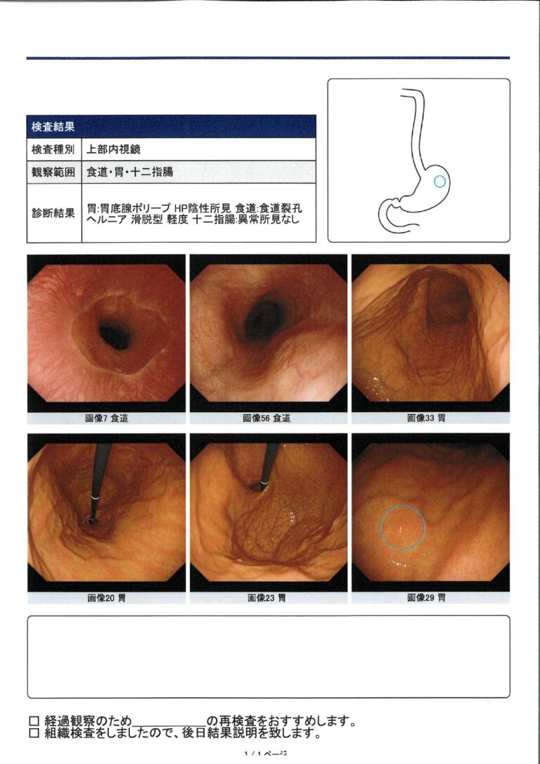 胃カメラ検査レポート